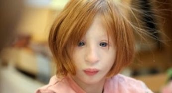Skutečna Malenka: Jaké jsou plány na život nejmenší dívky na světě, která váží pouze 10 kilogramů