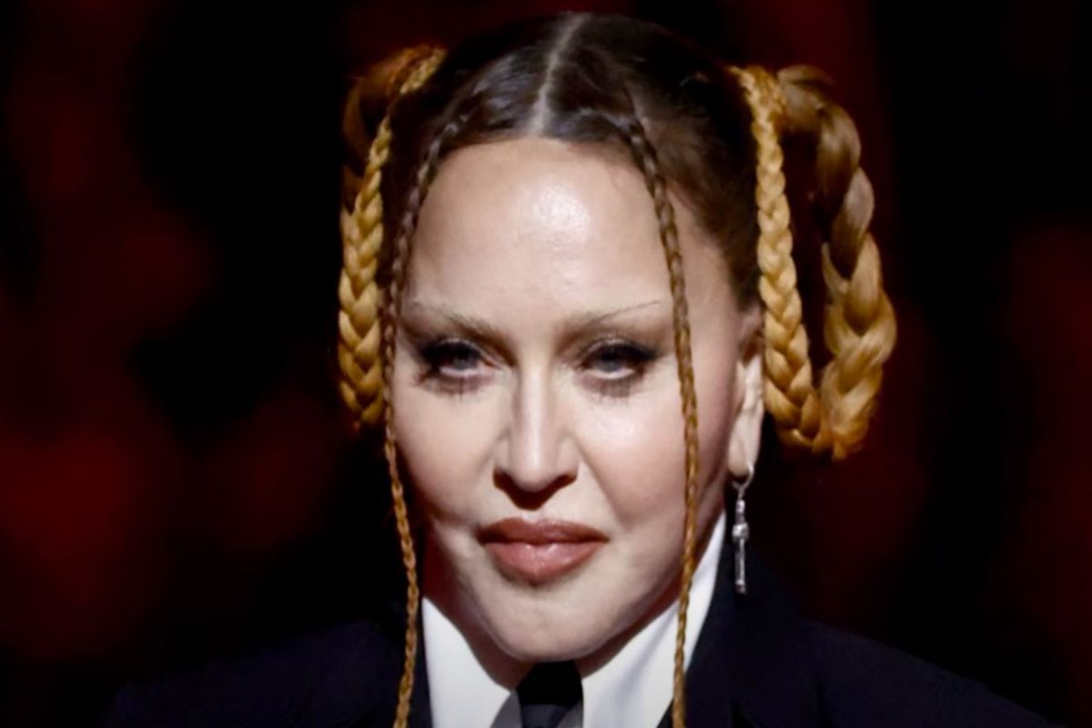 Madonna konečně přiznala, že podstoupila plastickou operaci: Ukázala, jak vypadá teď