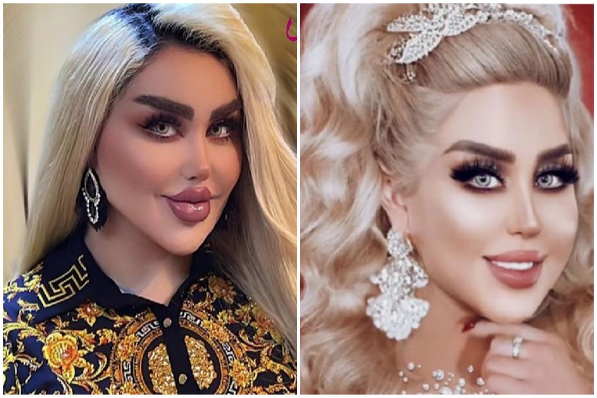 Žena podstoupila 43 operací, aby vypadala jako Barbie: Jak vypadala předtím